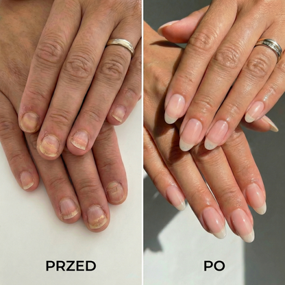 Kompleksowe piękno: Skóra, włosy i paznokcie pod pełną kontrolą