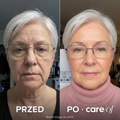 System Mikro Infuzji — Anti-Aging z Kolagenem & Peptydami