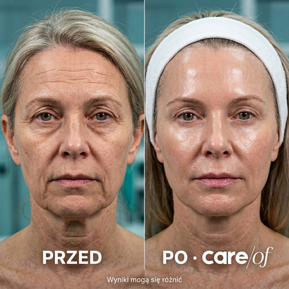 System Mikro Infuzji — Anti-Aging z Kolagenem & Peptydami