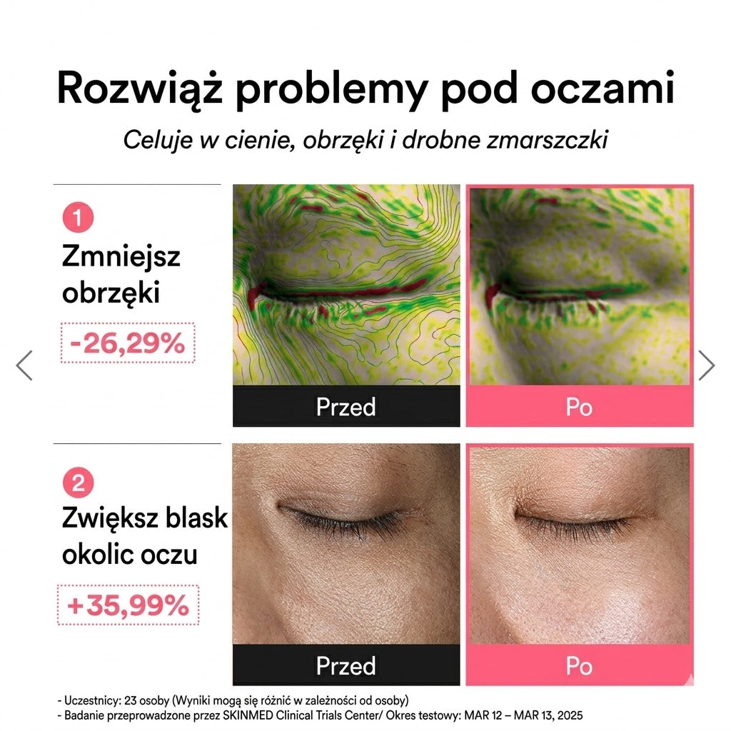 Gelly Eye Mask — Płatki pod oczy anti-cernes & anti-poches