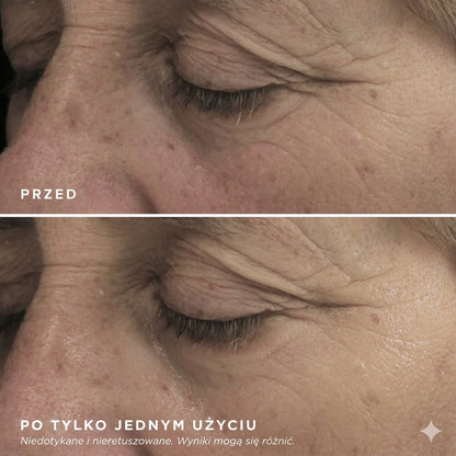 Gelly Eye Mask — Płatki pod oczy anti-cernes & anti-poches
